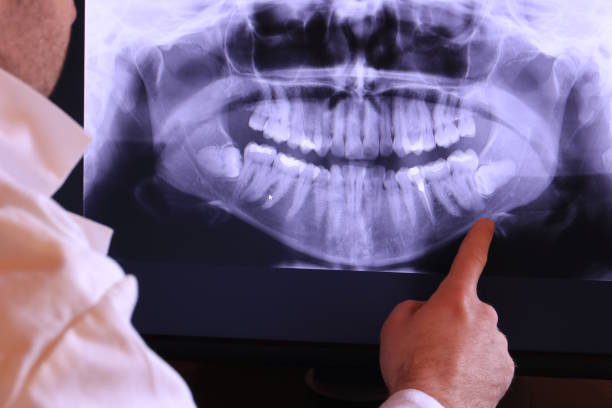 Best Emergency Dentist for Knocked-Out Tooth in Amherst, TX